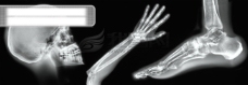 医学透视人体骨骼探索研究全方位平面设计素材辞典